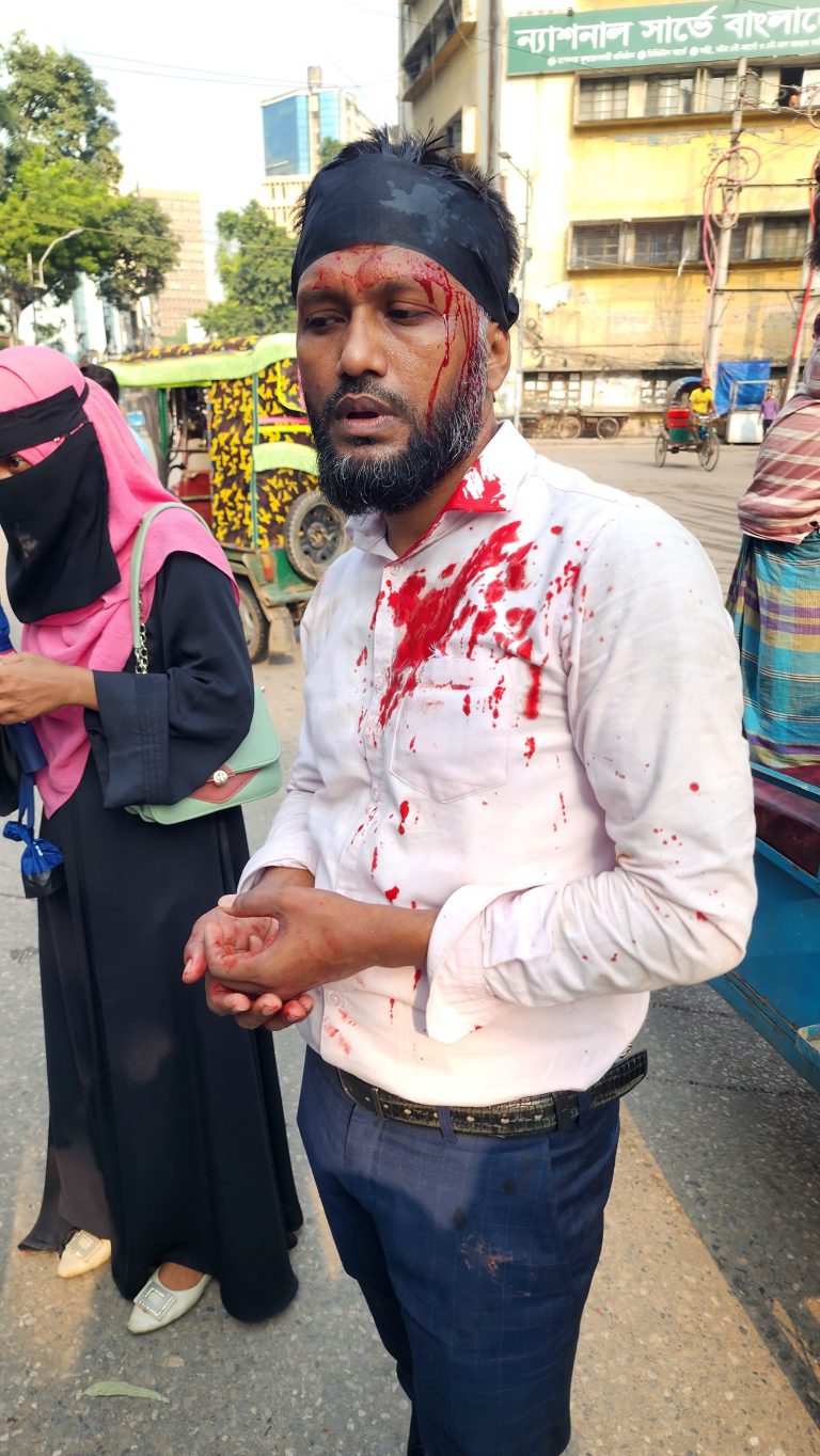 ইসলামী ব্যাংক থেকে চাকুরিচ্যুত কর্মকর্তাদের উপর জামায়াত শিবিরের বর্বরোচিত হামলা